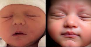 This Little Piggy 3D/4D and HD Live Ultrasound