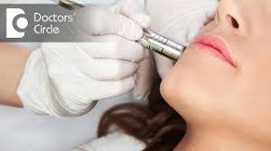 Will Open Pores Shrink After Laser Treatment Dr Nischal K Youtube