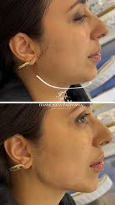 Ela queria realçar sua beleza, não mudar quem é. 💫, Buscava aquele toque  sutil que fizesse as pessoas notarem, sem saber exatamente o que foi feito.  Algo que despertasse comentários como:, “Você está ...