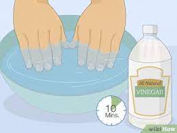 3 Ways To Get Rid Of White Spots On Your Nails - Wikihow