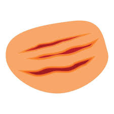 Image result for Skin Trauma