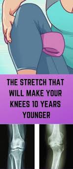 First of all, we must know what is the hyperextended knee and how to fix hyperextended knee? Hyperextended Knee