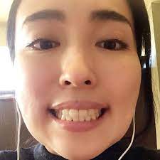 大人の歯列矯正 アラサーの大事な４年を捧げた歯並び改善 全部見せます baila 歯列矯正 歯並び アラサー
