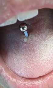 A wide variety of snake eyes piercing options are available to you, such as shape\pattern there are 27 suppliers who sells snake eyes piercing on alibaba.com, mainly located in asia. Was Kann Ich Gegen Ein Entzundetes Zungenpiercing Tun Gesundheit Und Medizin Medizin Piercing