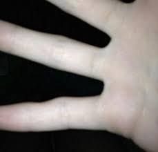 The small finger is called pinky finger. Do You Have Smartphone Pinky Expert Warns Of New Side Effect After Video Goes Viral