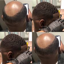 Ulahair provides cheap best human hair wigs bundles, lace front wigs, curly wigs, closure wigs, bob wigs, brazilian hair extensions for women. Man Weave New York Nyc Hair Unit Specialists