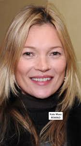 Katy Mixon Before and After