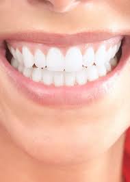 4 ways to whiten teeth fast. Fast Acting Adult Braces Faab Vs Traditional Braces Philadelphia