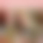 Image result for Compartment Syndrome