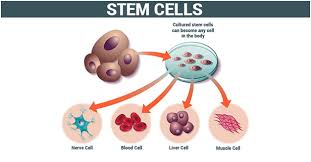 H eadaches, often with early morning vomiting. The Causes Of Blood Cancer And Possible Prevention