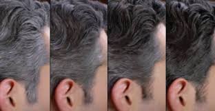 Elles sont très appréciées par les personnes voulant couvrir leurs cheveux blancs, qui peuvent espacer leurs colorations de quatre à six semaines. Comment Cacher Ses Cheveux Blancs