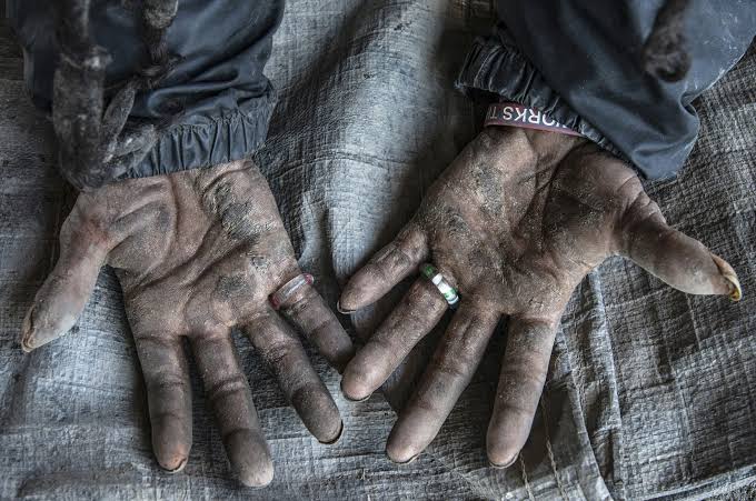 Jeffery's Hands
