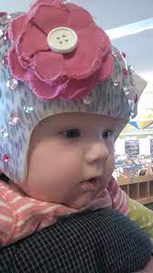 Cranial Orthotic Helmet Decoration Baby Helmet Helmet Helmet Ideas