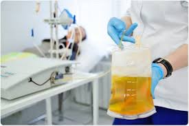 Image result for Plasma Transfusion