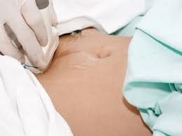 Keep it with your maternity notes. Pregnancy Scan Q A S Answered By Our Expert Madeformums