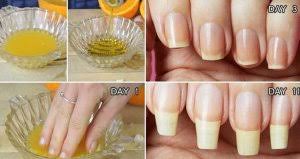 See full list on wikihow.com How To Grow Your Nails In One Day Secret Revealed Get Long Nails
