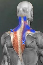 Ghim Tren How To Stop Back Pain