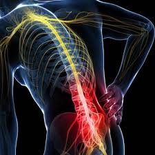 My disc had indeed burst and became infected with a staph. Hernie De Disc Home Facebook