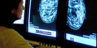 A tumor won't be smooth like a cyst. Breast Cancer May Return Even 20 Years Later Study Finds