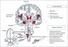 Image result for Taste Dysfunction
