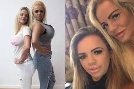 Những con thiêu thân nghiện dao kéo đến tàn tạ nhan sắc: Đừng mù quáng như  họ!