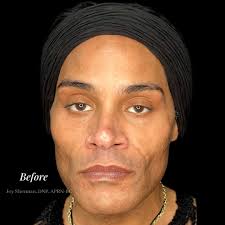 Joy Sherman, DNP, APRN