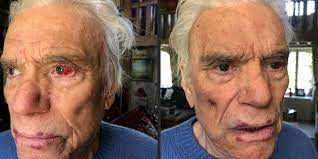 Bernard tapie bna tapi born 26 january 1943 is a french businessman politician and occasional actor singer and tv host he was minister of city aff. Assault On The Tapie Couple Their Injuries Revealed In Photos Teller Report