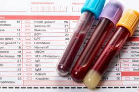 Hiv Test Blutuntersuchung In Der Schwangerschaft
