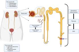 Image result for Postrenal Failure