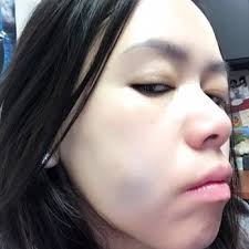 SAN GABRIEL VALLEY ORAL AND FACIAL SURGERY