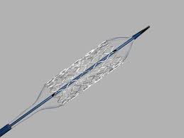 To reduce smooth muscle cell proliferation and vessel restenosis. Formula 418 Biliary Balloon Expandable Stent Cook Medical