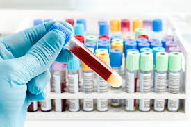 Edta blood 1 day theileria pcr detects t. Profiles Sunway Medical Lab