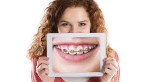 We did not find results for: Recommendations For Dental Braces Pain Dr Gaurav Malik Max Dental Care Best Dentist In Mohali