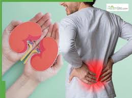 Signs of Kidney Damage At Night: 5 Warning Signs Your Kidneys Are Damaged |  TheHealthSite.com