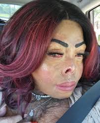 How this burn survivor turned tragedy into triumph by creating inspiring  makeup tutorials