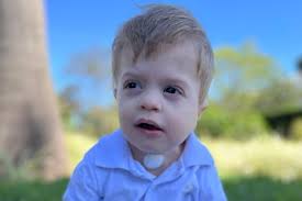 Vivi no modo sobrevivência”, diz mãe após bebê passar por 7 cirurgias