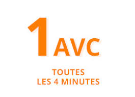 Comment reconnaître un avc ? Accident Vasculaire Cerebral Avc Inserm La Science Pour La Sante