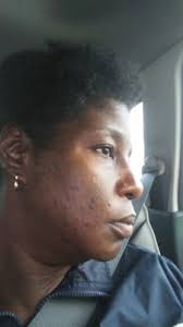 Dr. Jimmy Schmidt, 819 Peakwood Dr, Houston, TX 77090, US