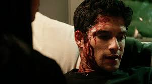 teen wolf ( gif series )