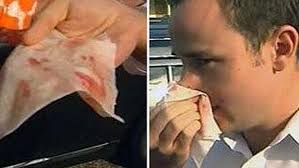 Hugh Whitfield's Instagram, Twitter & Facebook