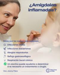 La inflamación de amígdalas (amigdalitis) no siempre significa infección.  Puede deberse a alergias, reflujo gastroesofágico o incluso a la  respiración bucal frecuente. 📌 Dato clave: Según la Mayo Clinic, la  mayoría de