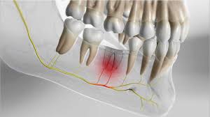 Maybe you would like to learn more about one of these? Causes Symptoms And Treatments Of Dry Socket