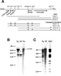 Top songs by linda kiraly. Altered Amyloid B Metabolism And Deposition In Genomic Based B Secretase Transgenic Mice Journal Of Biological Chemistry