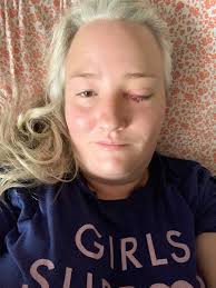 Had optic nerve sheath fenestration in January, decompression surgery in  June, leak repair in July, and now we are scheduling a cerebral angiogram  next week to see if a brain stent to