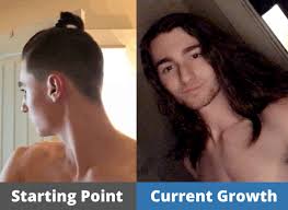 At any given time, each strand is in a different part of the cycle. Hair Growth Journey Before Afters From Our Members