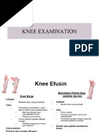 Image result for Ballottable Patella Sign
