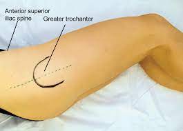 Pain or discomfort when sitting down, especially if it gets worse after sitting for a long time. Applied Basic Sciences Section 5 Postgraduate Orthopaedics