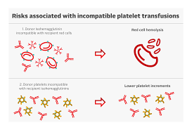 Image result for Platelet Transfusion