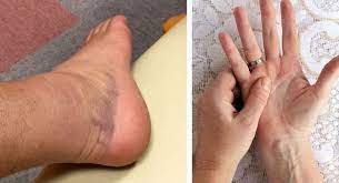 Berikut adalah tanda kanser rahim / ovari yang perlu diketahui oleh setiap wanita. Mohon Bantu Share Ya Inilah Tanda Tanda Awal Kanser Menyerang Ketahui Sebelum Terlambat Info Cepat