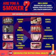 Sometimes symptoms are linked to certain cancer types. Bahagian Kesihatan Pergigian Johor Are You A Smoker Did You Know Smoking Can Not Only Harm Our General Health But Affect Our Oral Health Significantly There Is Overwhelming Evidence That Tobacco